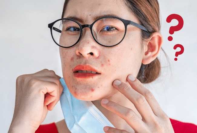 長痘痘的原因 長痘痘的原因
