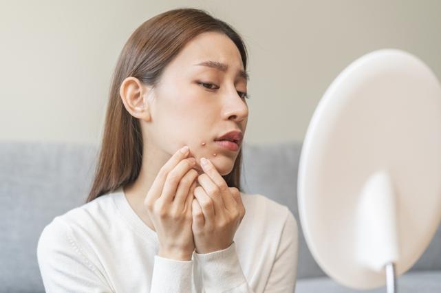 左臉頰長痘痘吃什麼? 左臉頰長痘痘吃什麼?