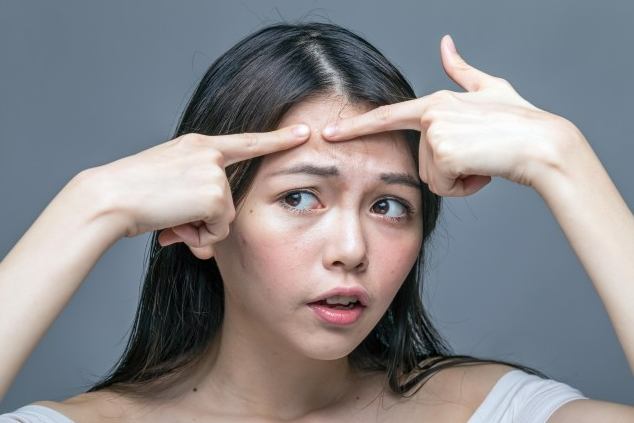 眉頭長痘痘怎麼消