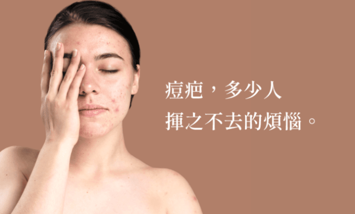 痘疤形成原因