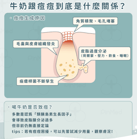 喝牛奶長痘痘 喝牛奶長痘痘