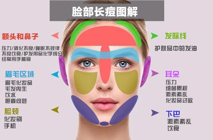 臉頰長痘痘原因 臉頰長痘痘原因